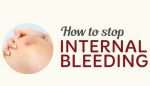 Effective Home Remedies for Internal Bleeding