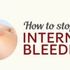 Internal Bleeding Thumbnail