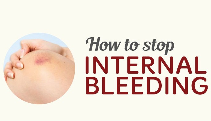 Internal Bleeding Thumbnail