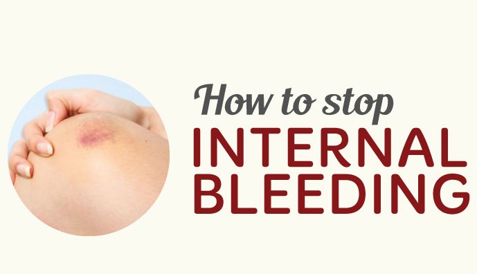 What Is Internal Bleeding Means